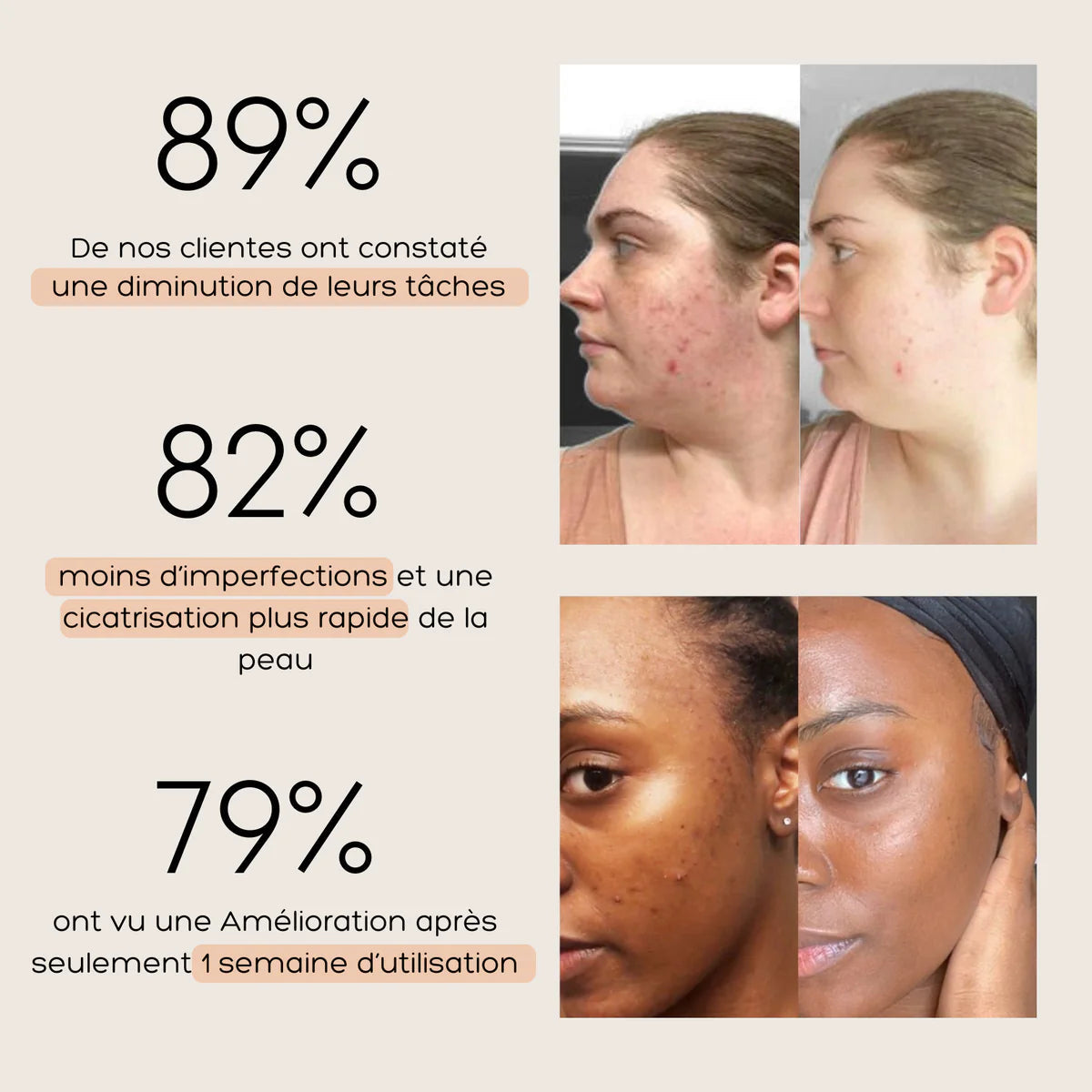 Curcuméa™